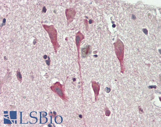 CNTNAP1 / CASPR / p190 Antibody - Human Brain, Cortex: Formalin-Fixed, Paraffin-Embedded (FFPE).  This image was taken for the unconjugated form of this product. Other forms have not been tested.