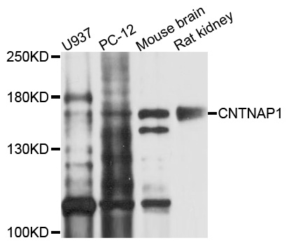 CNTNAP1 / CASPR / p190 Antibody - Western blot analysis of extracts of various cell lines, using CNTNAP1 antibody at 1:1000 dilution. The secondary antibody used was an HRP Goat Anti-Rabbit IgG (H+L) at 1:10000 dilution. Lysates were loaded 25ug per lane and 3% nonfat dry milk in TBST was used for blocking. An ECL Kit was used for detection and the exposure time was 90s.