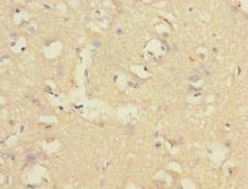 CNTNAP1 / CASPR / p190 Antibody - Immunohistochemistry of paraffin-embedded human brain tissue at dilution 1:100