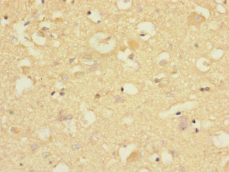 CNTNAP1 / CASPR / p190 Antibody - Immunohistochemistry of paraffin-embedded human brain tissue at dilution 1:100
