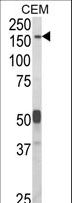 CNTNAP2 / CASPR2 Antibody - Western blot of CNTNAP2 Antibody in CEM cell line lysates (35 ug/lane). CNTNAP2 (arrow) was detected using the purified antibody.