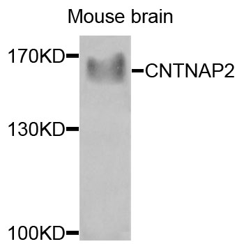 CNTNAP2 / CASPR2 Antibody - Western blot analysis of extracts of mouse brain cells.