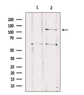 CNTNAP3 / CASPR3 Antibody - Western blot analysis of extracts of HuvEc cells using CNTNAP3 antibody. Lane 1 was treated with the blocking peptide.