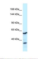 CNTROB Antibody - Western blot of Human Fetal Kidney . CNTROB antibody dilution 1.0 ug/ml.  This image was taken for the unconjugated form of this product. Other forms have not been tested.
