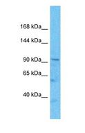 CNTROB Antibody - Western blot of CNTROB Antibody with human HepG2 Whole Cell lysate.  This image was taken for the unconjugated form of this product. Other forms have not been tested.
