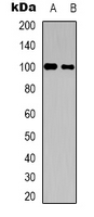 CNTROB Antibody - Western blot analysis of CNTROB expression in HepG2 (A); HUVEC (B) whole cell lysates.