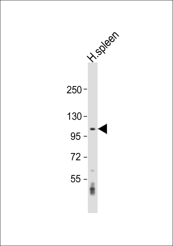 CNTROB Antibody - Anti-CNTROB Antibody at 1:1000 dilution + human spleen lysate Lysates/proteins at 20 ug per lane. Secondary Goat Anti-Rabbit IgG, (H+L), Peroxidase conjugated at 1:10000 dilution. Predicted band size: 101 kDa. Blocking/Dilution buffer: 5% NFDM/TBST.