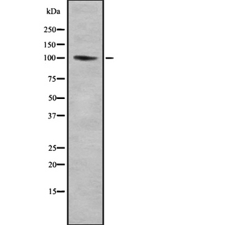 CNTROB Antibody - Western blot analysis of Centrobin using Jurkat whole cells lysates