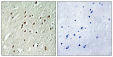 CNTROB Antibody - Peptide - + Immunohistochemistry analysis of paraffin-embedded human brain tissue using CNTROB antibody.