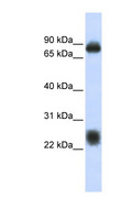 CO-029 / TSPAN8 Antibody - TSPAN8 antibody Western blot of Fetal Brain lysate. This image was taken for the unconjugated form of this product. Other forms have not been tested.