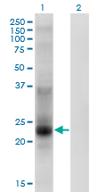 CO-029 / TSPAN8 Antibody - Western Blot analysis of TSPAN8 expression in transfected 293T cell line by TSPAN8 monoclonal antibody (M02), clone 1E5.Lane 1: TSPAN8 transfected lysate (Predicted MW: 26.1 KDa).Lane 2: Non-transfected lysate.