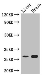 CO-029 / TSPAN8 Antibody - Western Blot Positive WB detected in: Mouse liver tissue, Mouse brain tissue All lanes: TSPAN8 antibody at 3µg/ml Secondary Goat polyclonal to rabbit IgG at 1/50000 dilution Predicted band size: 27 kDa Observed band size: 27 kDa