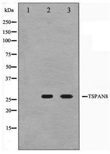 CO-029 / TSPAN8 Antibody - Western blot of Jurkat and K562 cell lysate using TSPAN8 Antibody