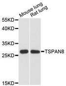 CO-029 / TSPAN8 Antibody - Western blot analysis of extracts of various cell lines, using TSPAN8 antibody at 1:3000 dilution. The secondary antibody used was an HRP Goat Anti-Rabbit IgG (H+L) at 1:10000 dilution. Lysates were loaded 25ug per lane and 3% nonfat dry milk in TBST was used for blocking. An ECL Kit was used for detection and the exposure time was 30s.