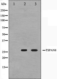 CO-029 / TSPAN8 Antibody - Western blot analysis on Jurkat and K562 cell lysates using TSPAN8 antibody. The lane on the left is treated with the antigen-specific peptide.