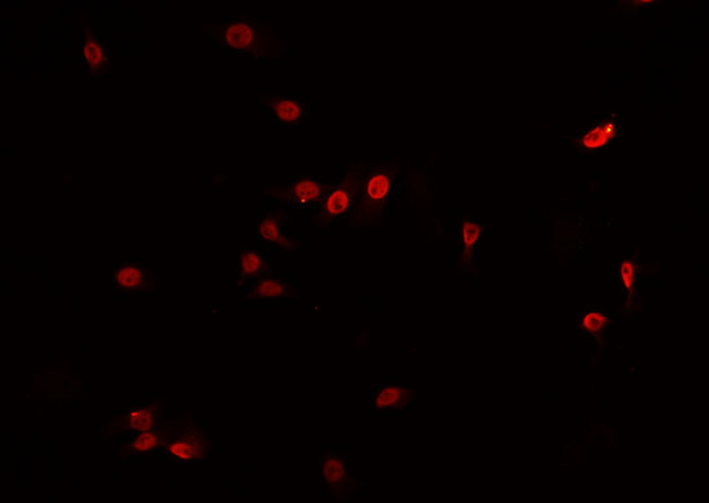 CO-029 / TSPAN8 Antibody - Staining HeLa cells by IF/ICC. The samples were fixed with PFA and permeabilized in 0.1% Triton X-100, then blocked in 10% serum for 45 min at 25°C. The primary antibody was diluted at 1:200 and incubated with the sample for 1 hour at 37°C. An Alexa Fluor 594 conjugated goat anti-rabbit IgG (H+L) antibody, diluted at 1/600, was used as secondary antibody.