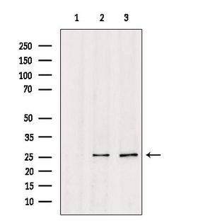 CO-029 / TSPAN8 Antibody - Western blot analysis of extracts of various samples using TSPAN8 antibody. Lane 1: 293 treated with blocking peptide. Lane 2: 293; Lane 3: HuvEc;