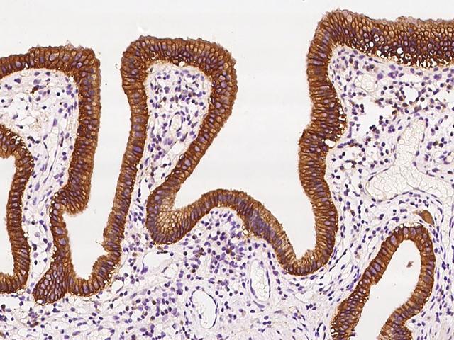 CO-029 / TSPAN8 Antibody - Immunochemical staining of human TSPAN8 in human gallbladder with rabbit polyclonal antibody at 1:200 dilution, formalin-fixed paraffin embedded sections.