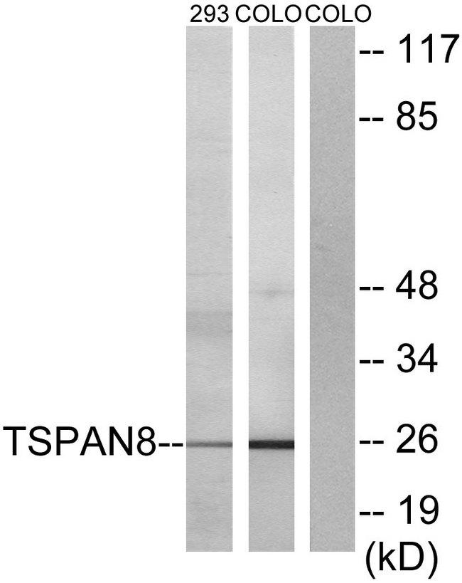 CO-029 / TSPAN8 Antibody - Western blot analysis of extracts from 293 cells and COLO cells, using TSPAN8 antibody.