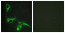 CO-029 / TSPAN8 Antibody - Peptide - + Immunofluorescence analysis of HeLa cells, using TSPAN8 antibody.