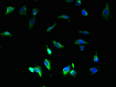 COA1 Antibody - Immunofluorescent analysis of U251 cells using COA1 Antibody at dilution of 1:100 and Alexa Fluor 488-congugated AffiniPure Goat Anti-Rabbit IgG(H+L)