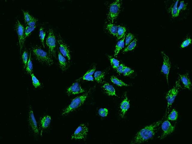 COA3 / CCDC56 Antibody - Immunofluorescence staining of CCDC56 in U251MG cells. Cells were fixed with 4% PFA, permeabilzed with 0.1% Triton X-100 in PBS, blocked with 10% serum, and incubated with rabbit anti-Human CCDC56 polyclonal antibody (dilution ratio 1:200) at 4°C overnight. Then cells were stained with the Alexa Fluor 488-conjugated Goat Anti-rabbit IgG secondary antibody (green) and counterstained with DAPI (blue). Positive staining was localized to Cytoplasm.