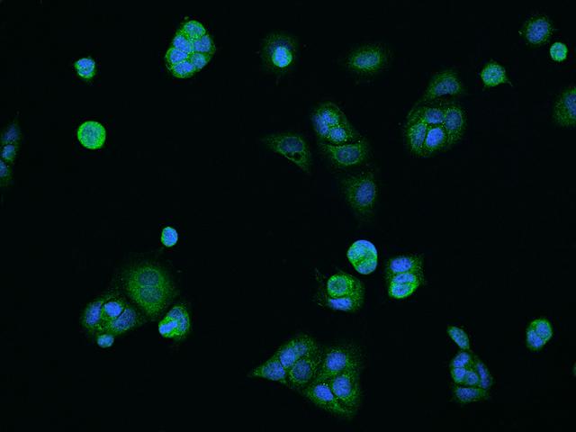 COA5 / C2orf64 Antibody - Immunofluorescence staining of COA5 in MCF7 cells. Cells were fixed with 4% PFA, permeabilzed with 0.1% Triton X-100 in PBS, blocked with 10% serum, and incubated with rabbit anti-Human COA5 polyclonal antibody (dilution ratio 1:200) at 4°C overnight. Then cells were stained with the Alexa Fluor 488-conjugated Goat Anti-rabbit IgG secondary antibody (green) and counterstained with DAPI (blue). Positive staining was localized to Cytoplasm.