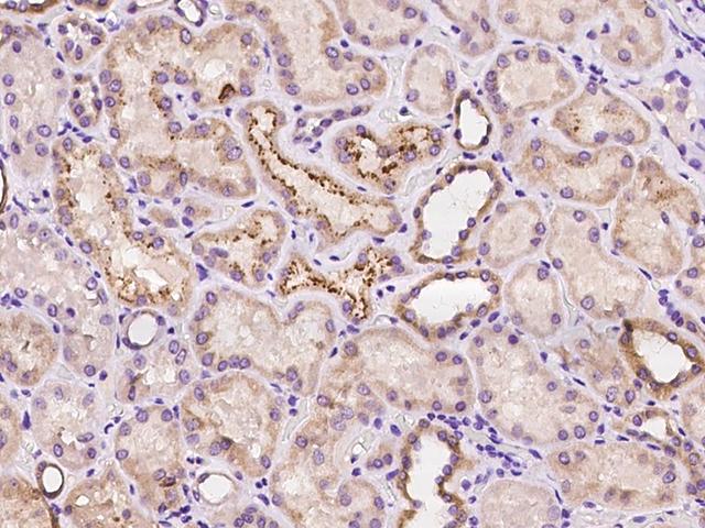 COA5 / C2orf64 Antibody - Immunochemical staining of human COA5 in human kidney with rabbit polyclonal antibody at 1:100 dilution, formalin-fixed paraffin embedded sections.