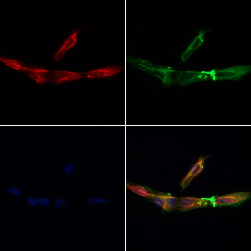 COA7 / SELRC1 Antibody - Staining HeLa cells by IF/ICC. The samples were fixed with PFA and permeabilized in 0.1% Triton X-100, then blocked in 10% serum for 45 min at 25°C. Samples were then incubated with primary Ab(1:200) and mouse anti-beta tubulin Ab(1:200) for 1 hour at 37°C. An AlexaFluor594 conjugated goat anti-rabbit IgG(H+L) Ab(1:200 Red) and an AlexaFluor488 conjugated goat anti-mouse IgG(H+L) Ab(1:600 Green) were used as the secondary antibod