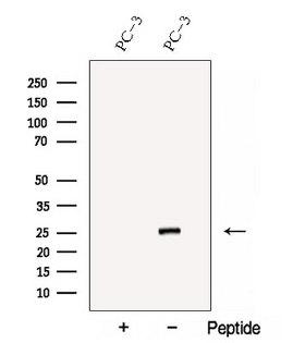 COA7 / SELRC1 Antibody