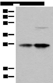 COA7 / SELRC1 Antibody - Western blot analysis of HL-60 and HEPG2 cell lysates  using COA7 Polyclonal Antibody at dilution of 1:550