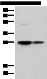 COA7 / SELRC1 Antibody - Western blot analysis of HEPG2 and HL-60 cell lysates  using COA7 Polyclonal Antibody at dilution of 1:550