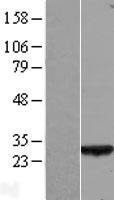 COA7 / SELRC1 Protein - Western validation with an anti-DDK antibody * L: Control HEK293 lysate R: Over-expression lysate