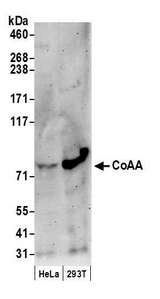 COAA / RBM14 Antibody - Detection of human CoAA by western blot. Samples: Whole cell lysate (50 µg) from HeLa and HEK293T cells prepared using NETN lysis buffer. Antibody: Affinity purified rabbit anti-CoAA antibody used for WB at 0.1 µg/ml. Detection: Chemiluminescence with an exposure time of 3 minutes.