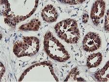 COASY Antibody - IHC of paraffin-embedded Human breast tissue using anti-COASY mouse monoclonal antibody.