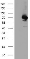 COASY Antibody - HEK293T cells were transfected with the pCMV6-ENTRY control (Left lane) or pCMV6-ENTRY COASY (Right lane) cDNA for 48 hrs and lysed. Equivalent amounts of cell lysates (5 ug per lane) were separated by SDS-PAGE and immunoblotted with anti-COASY.