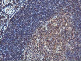 COASY Antibody - IHC of paraffin-embedded Human tonsil using anti-COASY mouse monoclonal antibody.