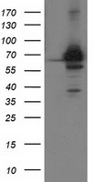 COASY Antibody - HEK293T cells were transfected with the pCMV6-ENTRY control (Left lane) or pCMV6-ENTRY COASY (Right lane) cDNA for 48 hrs and lysed. Equivalent amounts of cell lysates (5 ug per lane) were separated by SDS-PAGE and immunoblotted with anti-COASY.