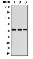 COASY Antibody - Western blot analysis of COASY expression in HeLa (A); A431 (B); Raw264.7 (C) whole cell lysates.