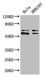 COASY Antibody - Positive WB detected in:Hela whole cell lysate,HEK293 whole cell lysate;All lanes: COASY antibody at 3.4ug/ml;Secondary;Goat polyclonal to rabbit IgG at 1/50000 dilution;Predicted band size: 63,66 kDa;Observed band size: 63,66 kDa;