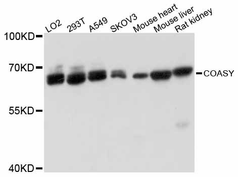COASY Antibody - Western blot analysis of extracts of various cell lines, using COASY antibody at 1:3000 dilution. The secondary antibody used was an HRP Goat Anti-Rabbit IgG (H+L) at 1:10000 dilution. Lysates were loaded 25ug per lane and 3% nonfat dry milk in TBST was used for blocking. An ECL Kit was used for detection and the exposure time was 1s.