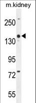 COBL Antibody - COBL Antibody western blot of mouse kidney tissue lysates (35 ug/lane). The COBL antibody detected the COBL protein (arrow).