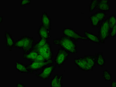 COBLL1 Antibody - Immunofluorescent analysis of Hela cells using COBLL1 Antibody at dilution of 1:100 and Alexa Fluor 488-congugated AffiniPure Goat Anti-Rabbit IgG(H+L)