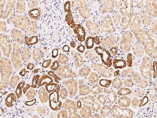 COBLL1 Antibody - Immunochemical staining of human COBLL1 in human kidney with rabbit polyclonal antibody at 1:100 dilution, formalin-fixed paraffin embedded sections.