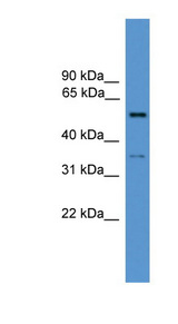Cochlin / COCH Antibody - COCH antibody Western blot of Placenta lysate.  This image was taken for the unconjugated form of this product. Other forms have not been tested.