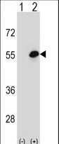 Cochlin / COCH Antibody - Western blot of COCH (arrow) using rabbit polyclonal COCH Antibody. 293 cell lysates (2 ug/lane) either nontransfected (Lane 1) or transiently transfected (Lane 2) with the COCH gene.