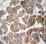 Cochlin / COCH Antibody - COCH Antibody immunohistochemistry of formalin-fixed and paraffin-embedded human skeletal muscle followed by peroxidase-conjugated secondary antibody and DAB staining.