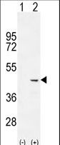 Cochlin / COCH Antibody - Western blot of COCH (arrow) using rabbit polyclonal COCH Antibody. 293 cell lysates (2 ug/lane) either nontransfected (Lane 1) or transiently transfected (Lane 2) with the COCH gene.