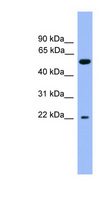 Cochlin / COCH Antibody - COCH antibody Western blot of Fetal Liver lysate.  This image was taken for the unconjugated form of this product. Other forms have not been tested.