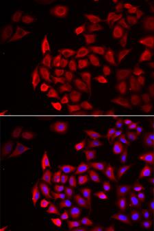 Cochlin / COCH Antibody - Immunofluorescence analysis of HeLa cell using COCH antibody. Blue: DAPI for nuclear staining.